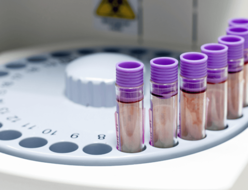 Analisi del sangue: il nostro pacchetto per il tuo check-up annuale